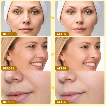 Bee Venom Anti-Wrinkle Face Cream – Moisturizing & Firming Skin Care
